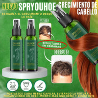 Cabello más fuerte, más grueso y con más vida en tiempo récord (spry crecimiento de cabello) x4 frascos+ envío gratis