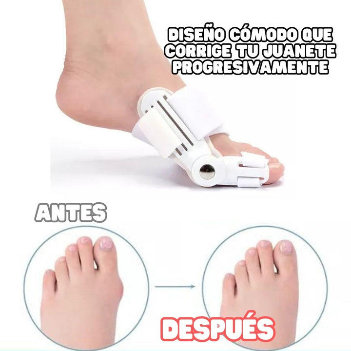 Mejora tu pisada 👟 Férula correctora de juanete X2 + envío gratis