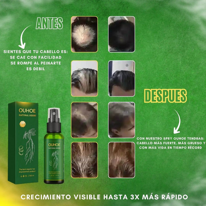 Cabello más fuerte, más grueso y con más vida en tiempo récord (spry crecimiento de cabello) x4 frascos+ envío gratis